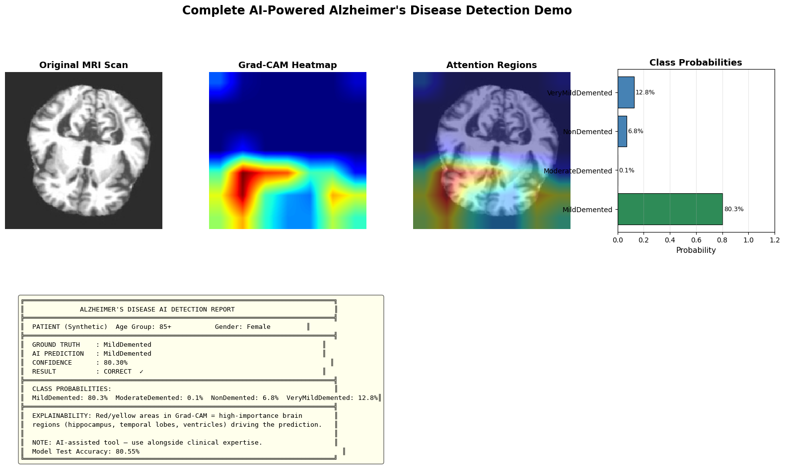 Grad-CAM Heatmapfor Alzheimer’s Classification